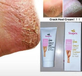 Soapex Crack Heel Cream